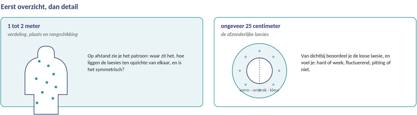 Eerst overzicht, dan detail